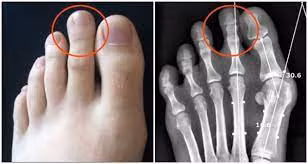 Những người này thường có khả năng trở thành nghệ sĩ hay vận động viên bởi khả năng ham mê thể thao và tính sáng tạo. Bên cạnh đó, họ có thể làm nghề doanh nhân, công an bởi bạn đủ khéo léo, sự khôn ngoan để có thể hoàn thành tốt nhiệm vụ của mình. 