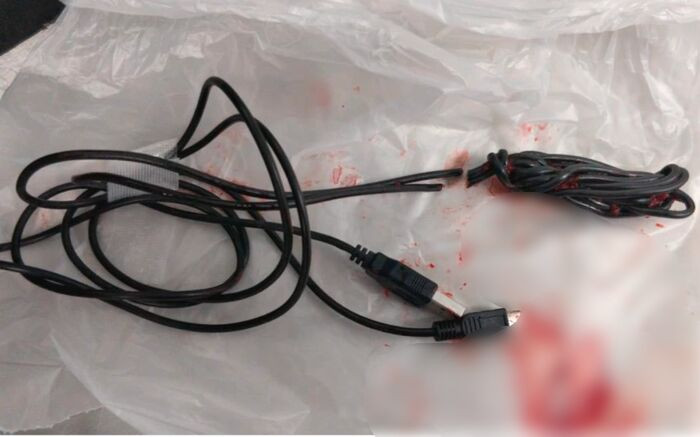 Do thu “cau nho”, thieu nien 15 tuoi nhap vien khan cap-Hinh-2