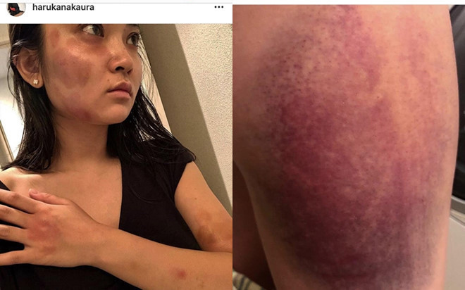 Sao nam Trung Quoc bi canh sat bat giu vi danh ban gai-Hinh-2