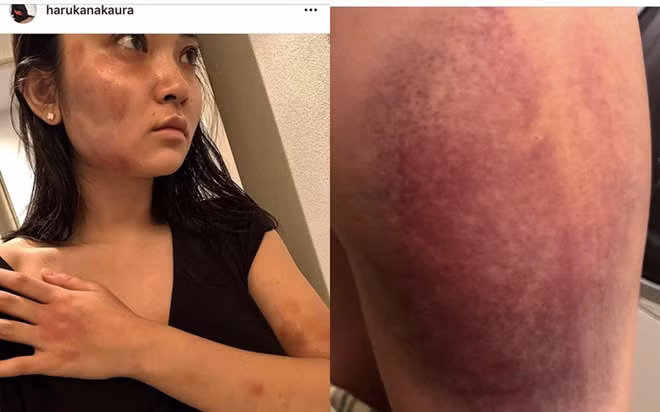 Sao nam Trung Quoc bi canh sat bat giu vi danh ban gai-Hinh-2