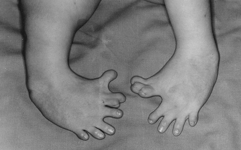 Thảm họa Thalidomide đã gây chấn động giới y khoa thời bấy giờ. Nó đã đặt ra cho các nhà khoa học và các bác sĩ vấn đề rất lớn trong việc thử nghiệm thuốc trước khi đưa ra thị trường.