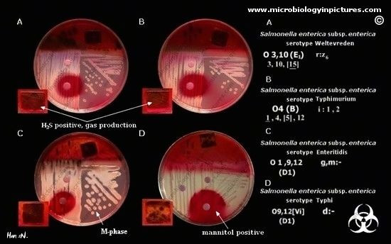 Bệnh hiểm nghèo này dễ lan khi vi trùng trong phân người bị bệnh nhiễm vào thức ăn hay thức uống và truyền sang người khác.