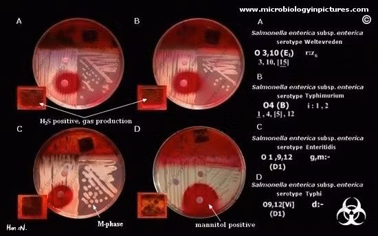 Bệnh hiểm nghèo này dễ lan khi vi trùng trong phân người bị bệnh nhiễm vào thức ăn hay thức uống và truyền sang người khác.