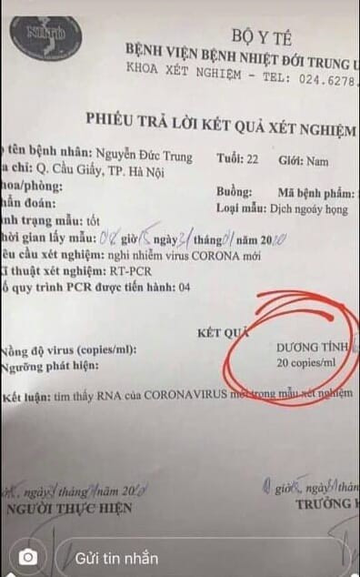 Xuat hien phieu xet nghiem gia co ket qua duong tinh virus corona