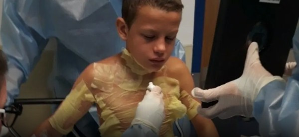 Cô bé suýt mất mạng vì bắt chước trò “ảo thuật” trên TikTok - Hình 2 Co be suyt mat mang vi bat chuoc tro “ao thuat” tren TikTok-Hinh-2