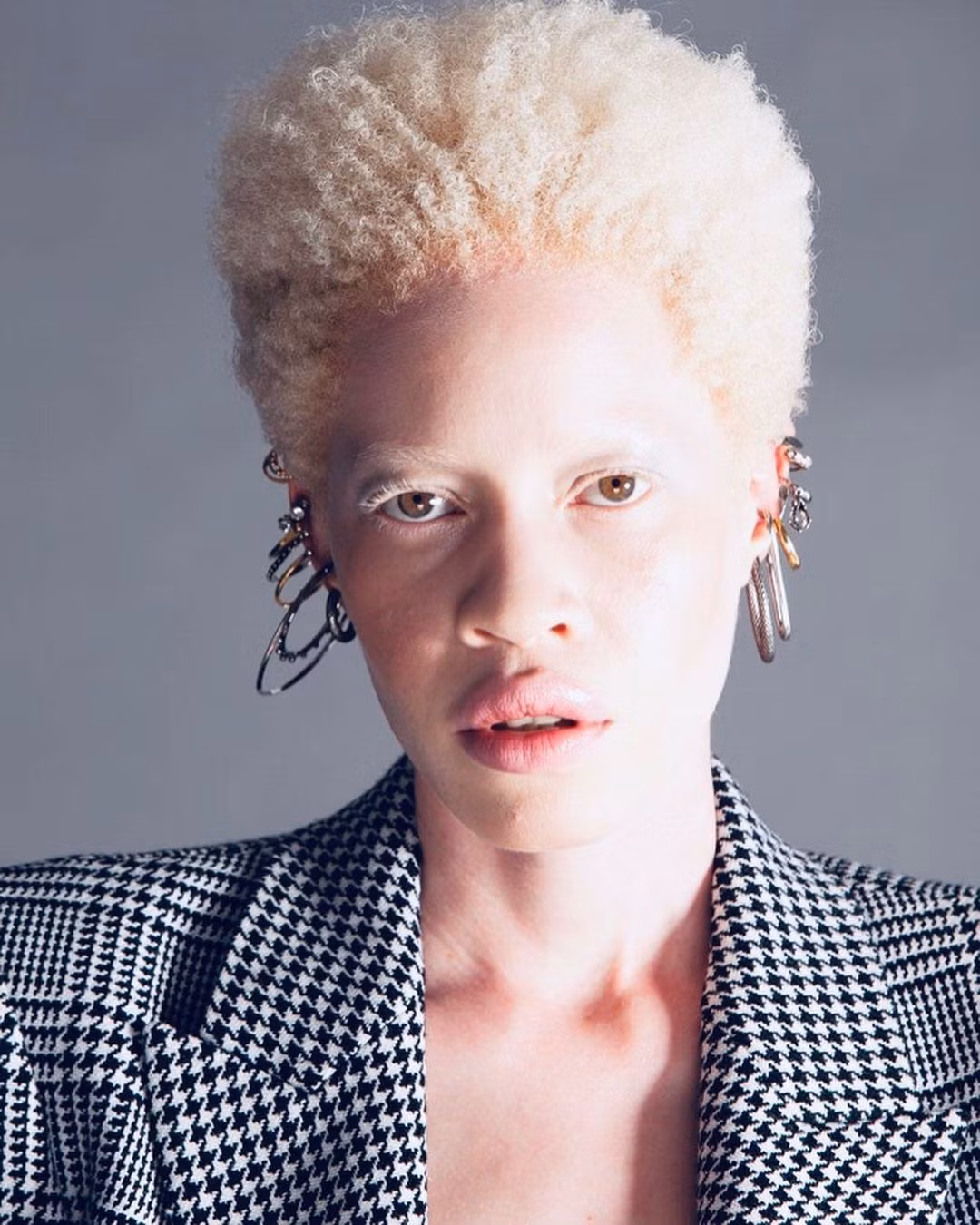  Diandra Forrest là người mẫu bạch tạng đầu tiên ký hợp đồng với công ty Elite Models, New York, Mỹ. Cô chia sẻ: "Không dễ gì để trở thành người mẫu với chứng bệnh bạch tạng. Suốt nhiều năm trôi qua, tôi đã tìm thấy sự tự tin. Tôi hy vọng những đứa trẻ mắc bệnh bạch tạng sẽ biết được vẻ đẹp của mình". Ảnh: Diandra Forrest.