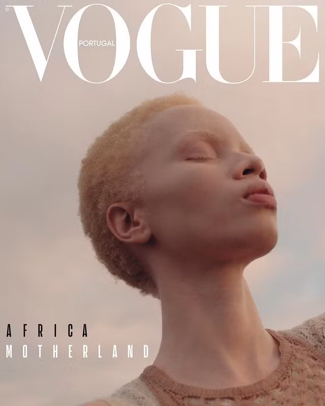  Thando Hopa làm người mẫu, luật sư kiêm nhà hoạt động xã hội. Năm 2019, cô đánh dấu mốc lịch sử khi trở thành người mẫu bạch tạng đầu tiên chụp ảnh bìa Vogue.