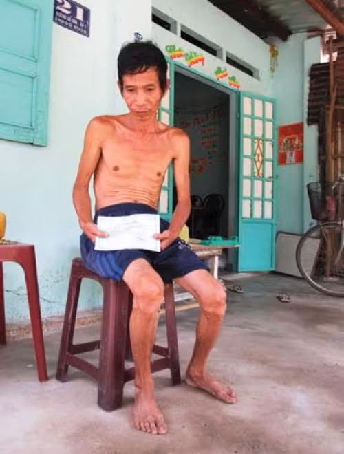 Ông Lê Minh Dũng đang phải chống chọi với căn bệnh viêm phổi nặng từ nhiều năm qua của mình. Ảnh: Phan Trí.