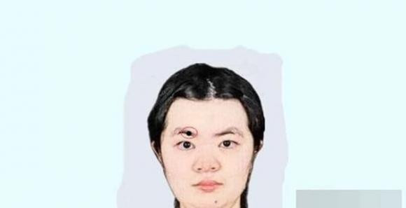 Phu nu so huu 5 not ruoi nay vuong phu ich tu, ca doi giau sang