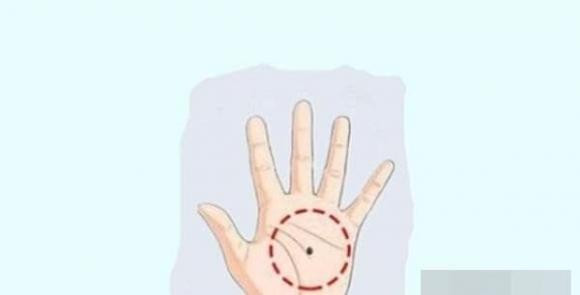 Phu nu so huu 5 not ruoi nay vuong phu ich tu, ca doi giau sang-Hinh-2