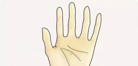 So huu 1 trong 6 not ruoi hau van no hoa, cong thanh danh toai-Hinh-6