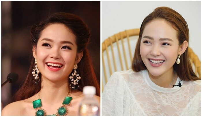 Không chỉ cằm khác biệt, nữ ca sĩ còn chỉnh nha để có hàm răng đều hơn, trắng hơn