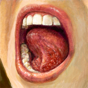 Erythroplakia xảy ra thường xuyên nhất ở bên dưới lưỡi, hoặc trên nướu sau răng hàm. Sử dụng một tấm gương và dưới ánh sáng, kiểm tra miệng của bạn một cách cẩn thận mỗi tháng một lần khi có bất kỳ dấu hiệu bất thường. Kéo lưỡi ra nhẹ nhàng với ngón tay sạch và kiểm tra bên dưới.