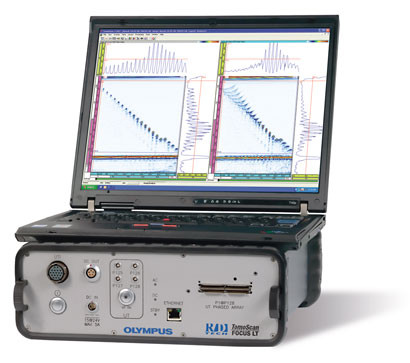 5. Siêu âm Tomoscan: được sử dụng để xác định sự tồn tại và vị trí của các hạch bạch huyết sưng trên cổ và mối quan hệ của nó với các mô lân cận. Hơn nữa, nó cũng là một phương pháp theo dõi kiểm tra sau khi xạ trị và phẫu thuật. Siêu âm tomoscan là vô hại, thuận tiện, chính xác và kinh phí thấp.