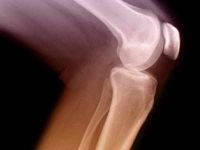 Điều trị bằng châm cứu có tác dụng kích thích các bộ phận khác nhau của cơ thể hoặc để giảm đau. Trong trường hợp này, người ta cho rằng kim còn sót lại bên trong đầu gối của cô là cố ý để tiếp tục kích thích sau khi điều trị đã kết thúc.