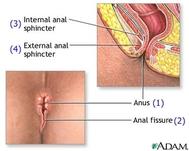 Hay có lỗ rò hậu môn (lỗ bất thường).