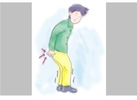 Những người có hậu môn thường xuyên sưng, đỏ và đau nhức.