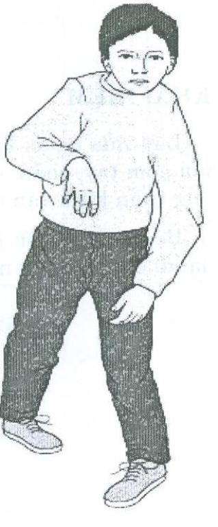 Bị mất cảm giác/ liệt một tay hoặc một chân.