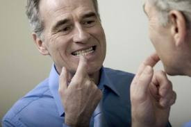 4. Răng lung lay: Khi ung thư phát triển, nướu không còn có thể giữ răng thật chặt. Do đó, bệnh nhân có xu hướng bị răng lung lay. Vì vậy, răng có xu hướng di chuyển khi chạm vào.