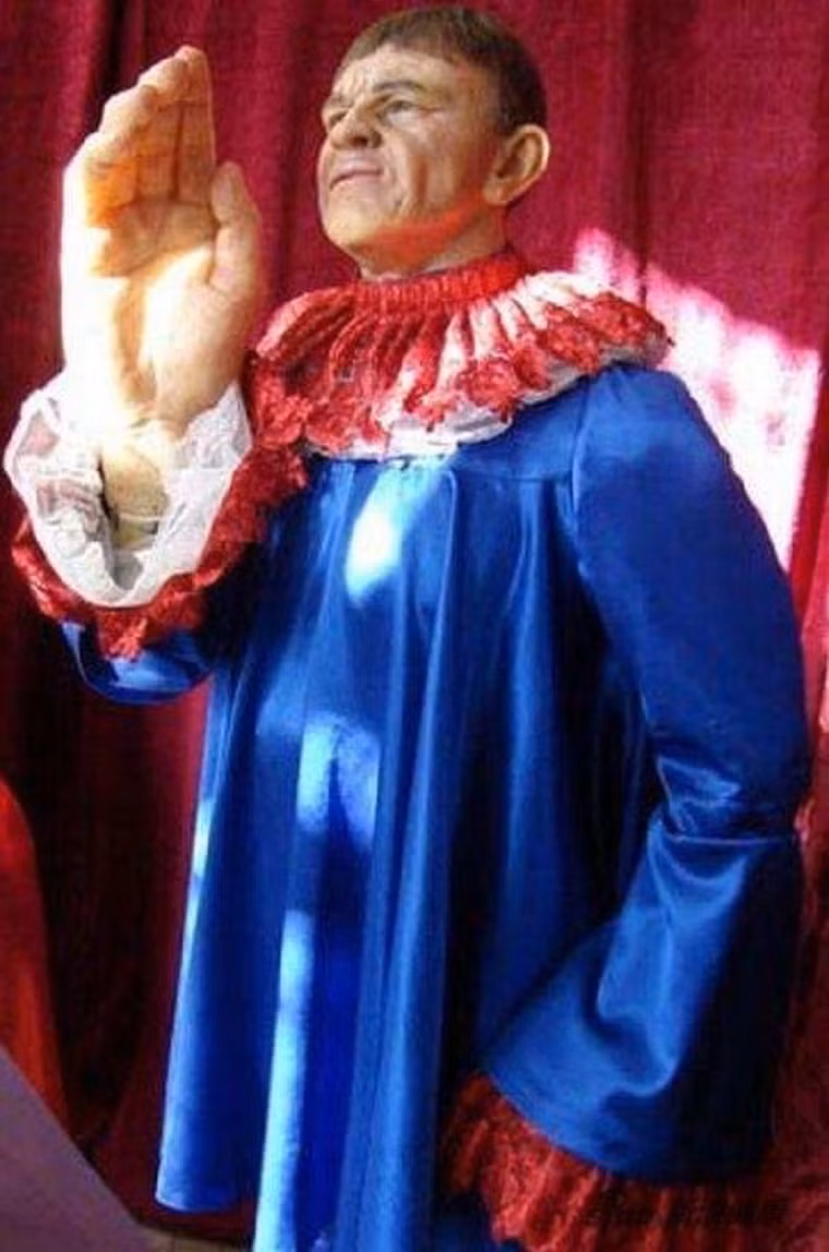 Bàn tay cỡ người khổng lồ khiến ông ấy phải may những chiếc áo có ống tay rộng