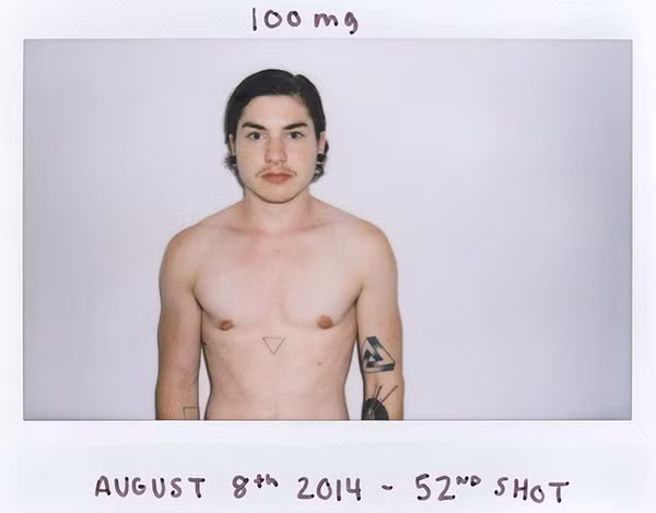 Lần tiêm testosterone thứ 52, ngày 8/8/2014, lông mày và râu mọc rậm hơn, đường nét trên cơ thể cũng đã rất nam tính.