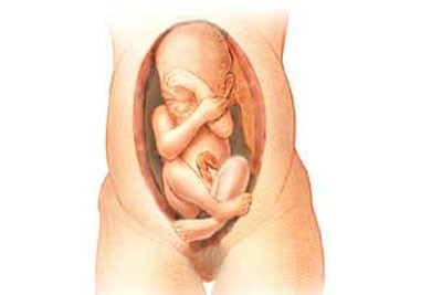 Thai nhi có vấn đề. Nếu bé có nhịp tim bất thường, bác sĩ sẽ phải tìm cách để em bé chào đời ngay lập tức bằng phương pháp sinh mổ. Hoặc trong trường hợp thai nhi bị dị tật, bác sỹ cũng sẽ chỉ định sinh mổ để an toàn cho tính mạng của trẻ sơ sinh. Thai nhi có vấn đề. Nếu bé có nhịp tim bất thường, bác sĩ sẽ phải tìm cách để em bé chào đời ngay lập tức bằng phương pháp sinh mổ. Hoặc trong trường hợp thai nhi bị dị tật, bác sỹ cũng sẽ chỉ định sinh mổ để an toàn cho tính mạng của trẻ sơ sinh.