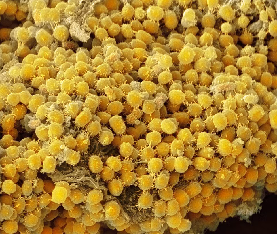 Chuỗi vi khuẩn màu vàng ký sinh trong nướu, lưỡi.