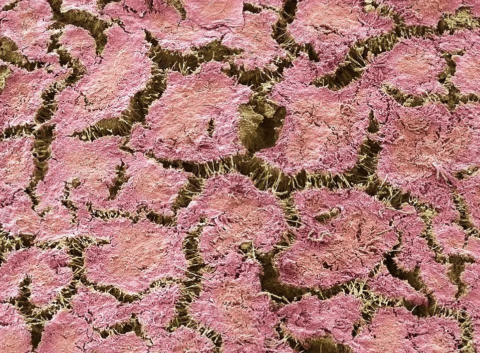 Bề mặt của mảng bám trên răng được phóng to bởi kính hiển vi mà không thể nhìn thấy bằng mắt thường.