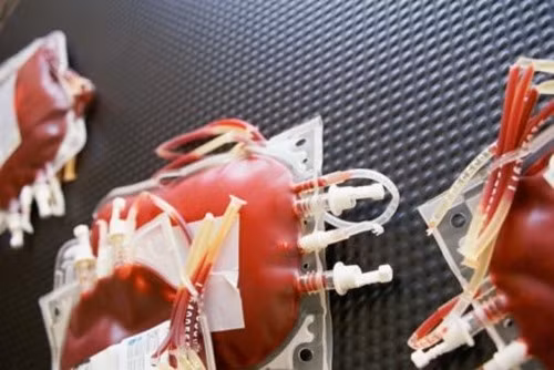 Truyền máu là tiếp nhận một lượng máu lớn vào cơ thể mình, do đó nếu bạn nhận máu của người nhiễm HIV, bạn chắc chắn bị lây nhiễm. Nước ta quy định các bệnh viện phải xét nghiệm và loại bỏ máu có HIV, sốt rét, giang mai, viêm gan…