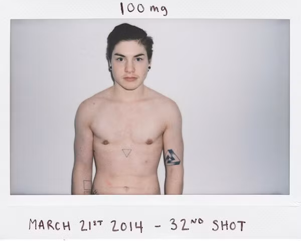 Ngày 21/3/2014, sau lần tiêm testosterone lần thứ 32.