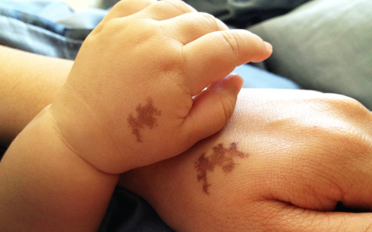 Cay đắng phát hiện con gái bạn thân có vết bớt giống chồng mình Cay dang phat hien con gai ban than co vet bot giong chong minh