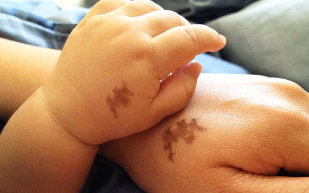 Cay dang phat hien con gai ban than co vet bot giong chong minh