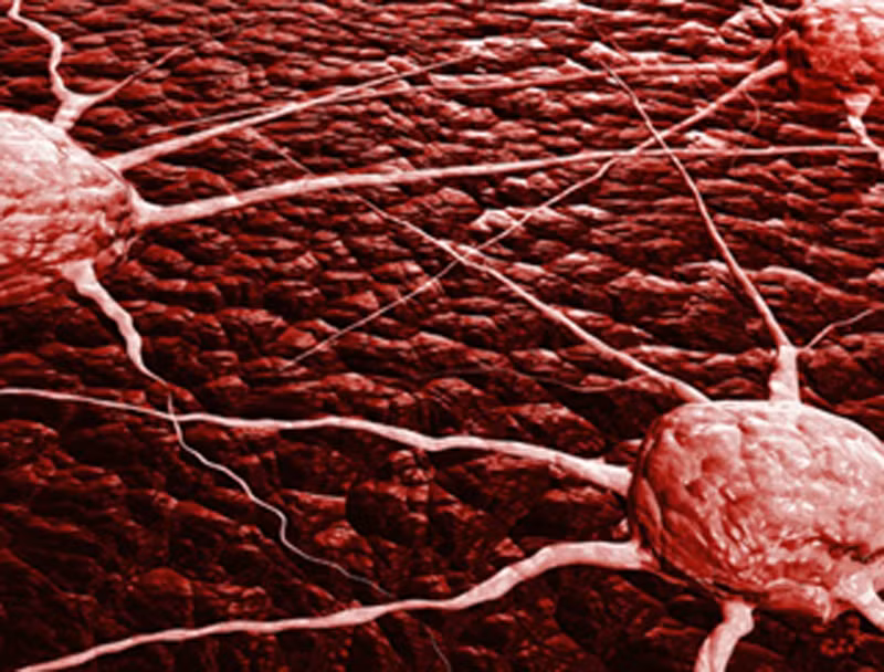 Bên cạnh đó, một nghiên cứu trên chuột thực hiện năm 2007 cũng chỉ ra curcumin giúp ngăn chặn sự di căn của tế bào ung thư vú khắp cơ thể.