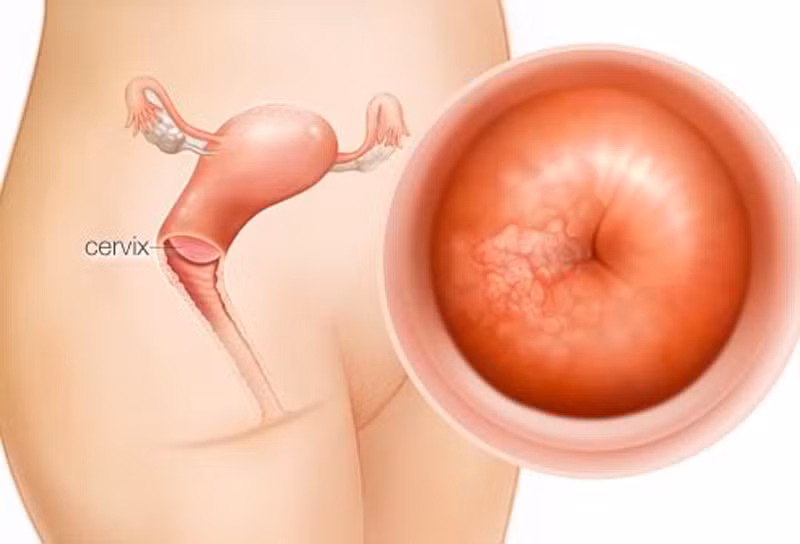 Nhẹ nhàng di chuyển ngón tay đến vị trí cổ tử cung. Cổ tử cung phụ nữ giống như miếng cao su, nhẵn mịn. Đối với phụ nữ chưa từng sinh con, cổ tử cung hơi võng xuống trong khi các bà mẹ lại giống như hình quả bóng.