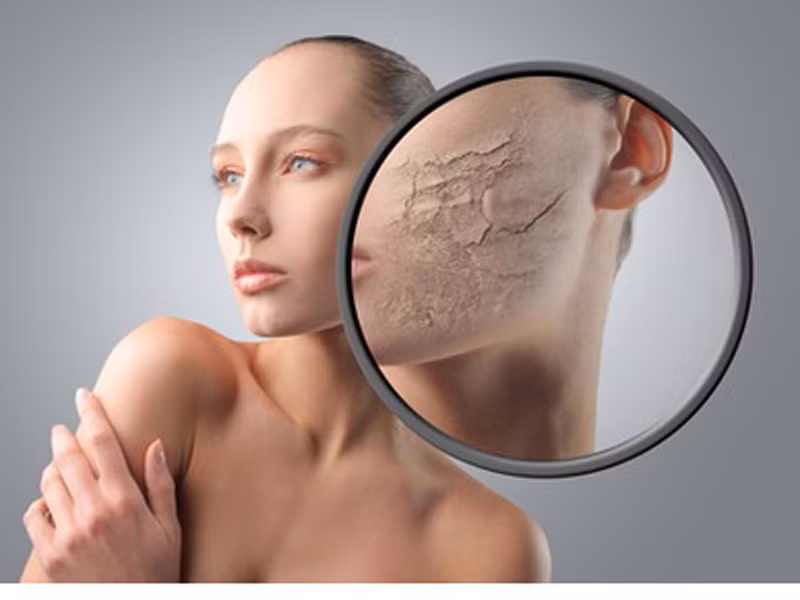 Da trở nên cứng, khô. Các vấn đề như huyết áp cao, thận đôi khi dẫn đến tình trạng da trở nên cứng hơn. Trường hợp da trở nên đặc biệt khô cứng kèm cảm giác ngứa ngáy chứng tỏ bạn đang gặp vấn đề về nội tiết tố.