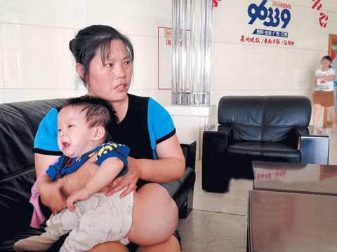 Khối u lớn nằm ngay sau hông cậu bé.