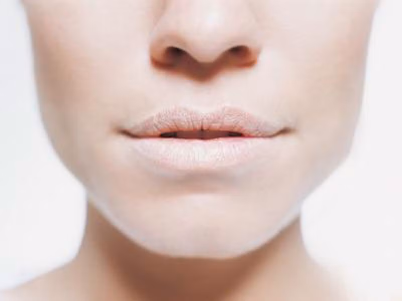  Khô miệng. Khô miệng xảy ra khi không có đủ lượng nước bọt trong khoang miệng. Nó không chỉ gây khó khăn trong việc nhai nuốt mà còn có thể đẩy bạn dễ đối diện với nguy cơ sâu răng hàng loạt.