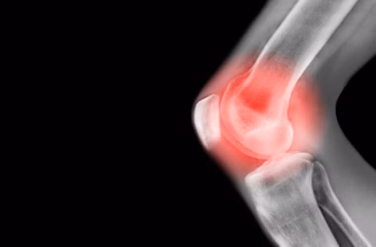 Ngoài công dụng ngăn ngừa ung thư, khoai môn có khả năng điều hòa huyết áp - lượng đường trong máu; chữa tiểu đường; thận và các bệnh về viêm khớp, u hạch.