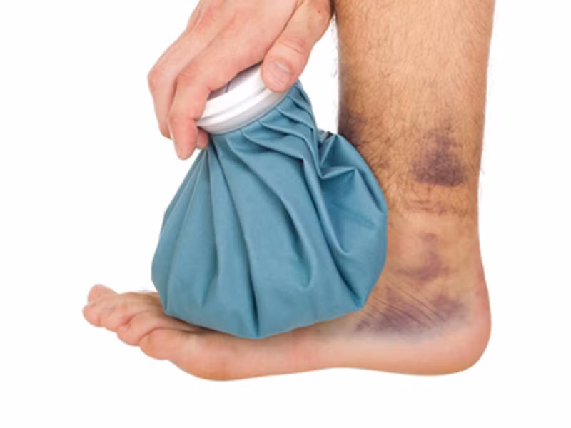 Trị vết thâm tím. Sử dụng miếng bông sạch thấm với giấm táo không pha loãng rồi bôi lên vết thâm tím sẽ giúp giảm đau và thu gọn dần kích thước của vết bầm. Các chuyên gia khuyến cáo, khi bị va chạm mạnh, nên sử dụng giấm càng sớm càng tốt.