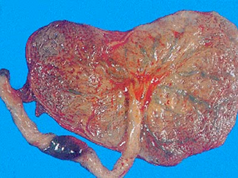 Nhau thai giúp tránh suy nhược, cải thiện nguồn sữa, tăng cường sinh lực. Việc ăn nhau thai của một đứa trẻ sau sinh khá phổ biến suốt hơn 2.000 năm qua ở Trung Quốc.