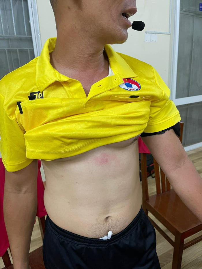 Can canh vet thuong cua tro ly trong tai khien Van Quyet bi treo gio