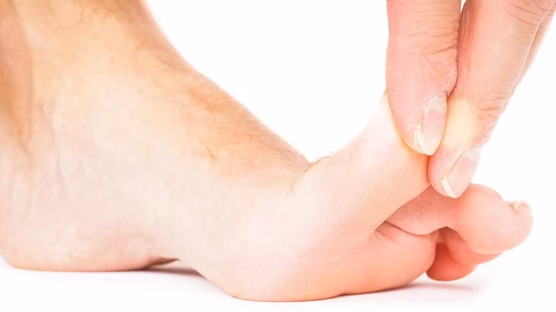 Pha an bang dau van chan dinh mau