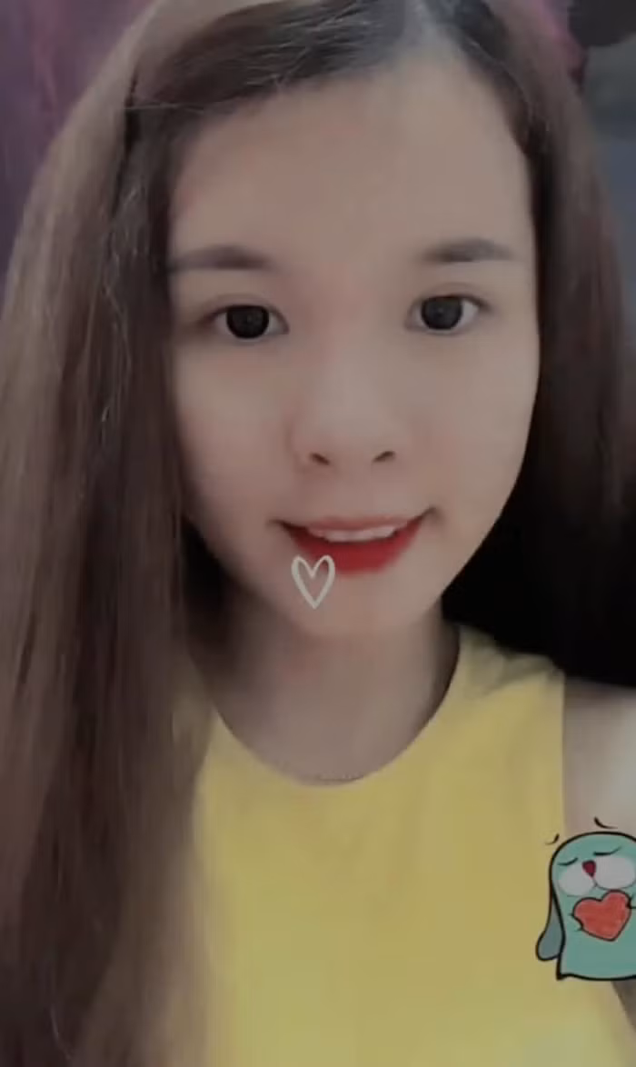 Anh thoi chua phau thuat tham my cua Ba Nhan Vlog-Hinh-7