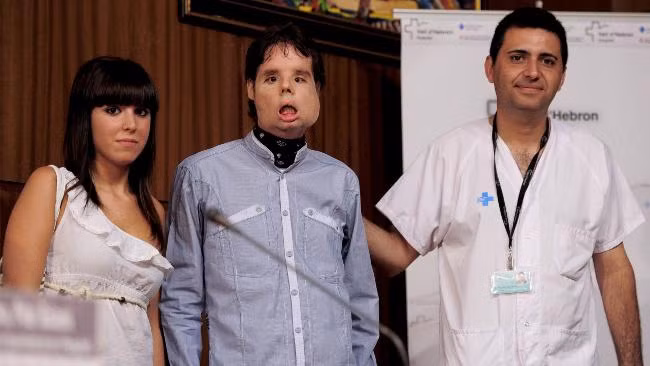 Sau hai năm chuẩn bị, một nhóm gồm 30 bác sĩ đã phẫu thuật ghép mặt cho Oscar vào tháng 3/2010. Cuộc phẫu thuật kéo dài 24 giờ để ghép da mặt, cơ, mí mắt, mũi, môi, hàm trên, toàn bộ răng, xương má, hàm dưới, vòm miệng.