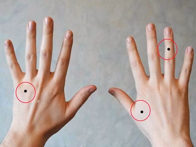 5 not ruoi long ban tay, 1/5 ca doi an nhan khong lo tien bac