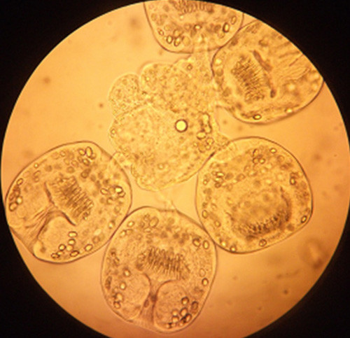 Sán dây chó dưới kính hiển vi.