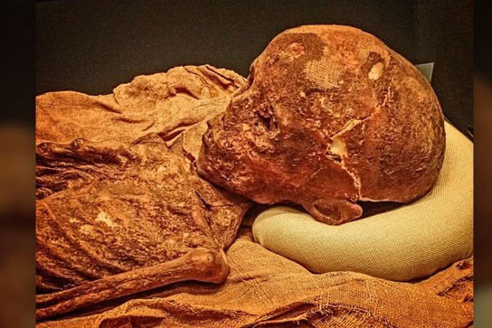 Xác ướp tiết lộ trẻ em Ai Cập cổ đại mắc chứng rối loạn máu Xac uop tiet lo tre em Ai Cap co dai mac chung roi loan mau