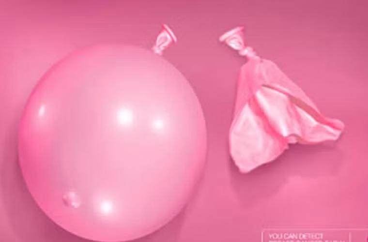 Hiện các nhà khoa học không ngừng nghiên cứu tìm ra cách ngăn ngừa, trong đó có nỗ lực tìm ra chủng ngừa ung thư vú.