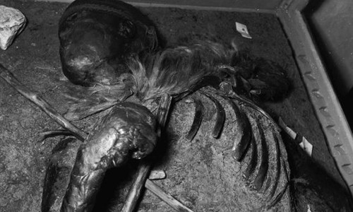 Xác ướp công chúa vùng Siberia 2.500 tuổi cho thấy cô từng mắc ung thư vú và nhiễm trùng tủy xương khi còn sống.