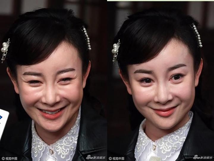 "Thần tiên tỷ tỷ" mất sự nghiệp vì giật chồng, biến dạng do dao kéo - Hình 5 "Thần tiên tỷ tỷ" mất sự nghiệp vì giật chồng, biến dạng do dao kéo ảnh 5